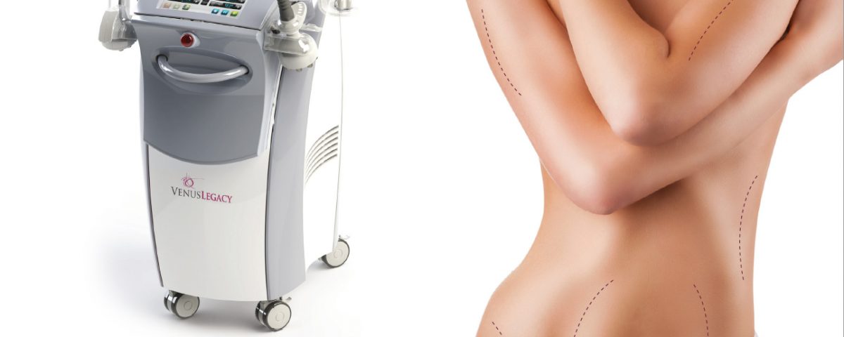 Zsírbontás 4D technológiával