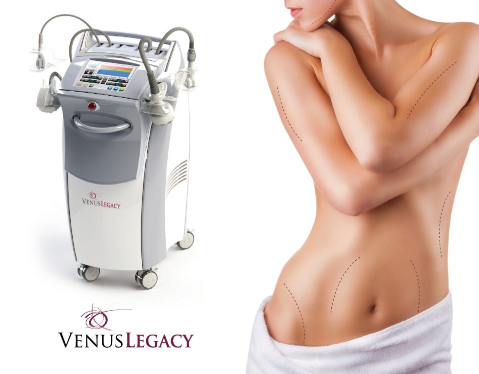 Zsírbontás 4D technológiával