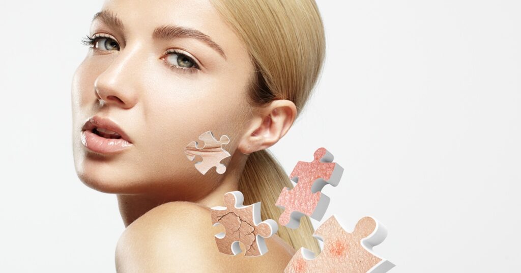 A bőr rugalmassága közvetlenül összefügg a kollagénnel