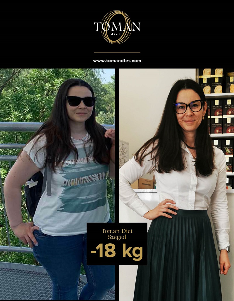 terhességi túlsúly - szegedi sikersztori